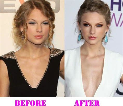 Taylor Swift Nose Job Before And After