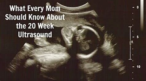 The Anatomy Ultrasound: Everything You Should Know