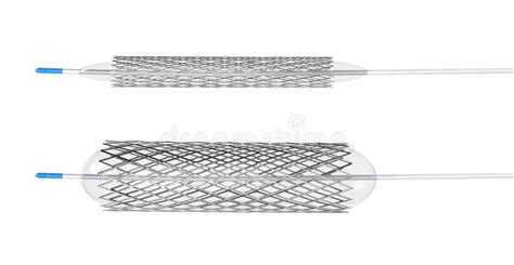 Stent for Balloon Angioplasty Stock Illustration - Illustration of circulatory, rendering: 159726380