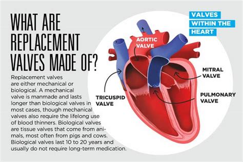 Making Heart-Valve Surgery a Little Less Scary | MountainView Hospital