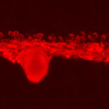 Horizontal cells – Retinal Microscopy