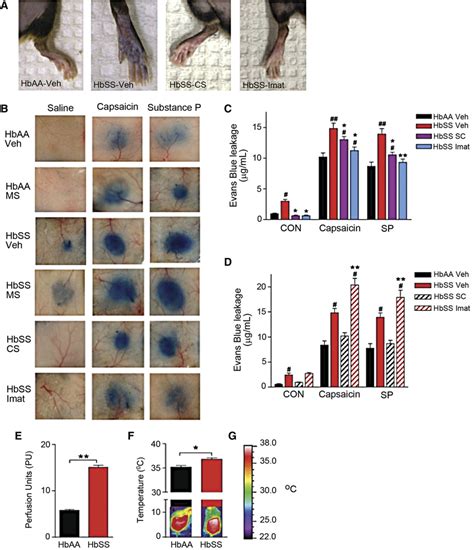 Neurogenic inflammation occurs in SCA. (A-B) Evans blue leakage evoked ...