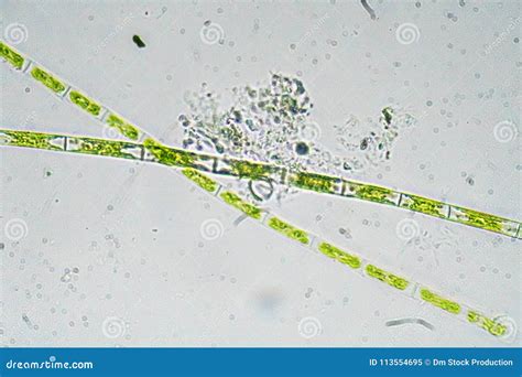 Algae under a microscope. stock image. Image of micro - 113554695