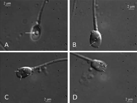 High-power light microscope micrograph of sperm heads ( × 1500). ( A ...