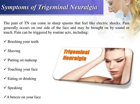 What Is Trigeminal Neuralgia And Causes Of Trigeminal Neuralgia | Images and Photos finder