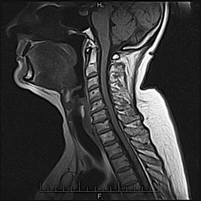 MRI Neck ️ near me in Orlando, FL - Imaging center Orlando