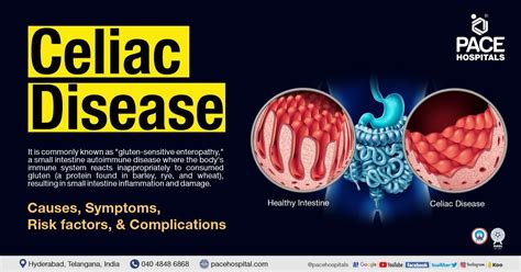 Celiac Disease Symptoms, Causes, Risk Factors and Complications