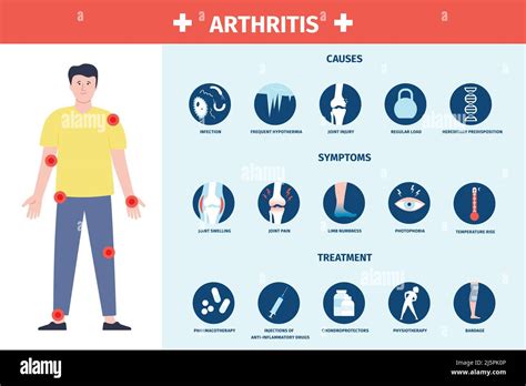 Arthritis infographic. Inflammation and care, symptoms and treatment ...