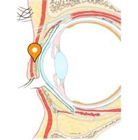 Tarsal glands - e-Anatomy - IMAIOS