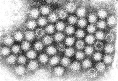Free picture: noroviruses, group, viruses, stomach, flu, gastroenteritis