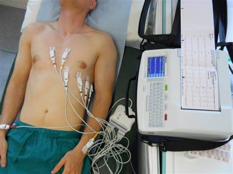 How To Use An Ecg Machine