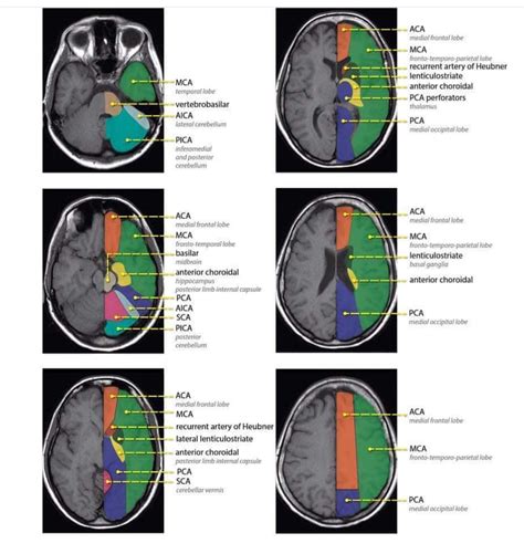 Radiology Student, Radiology Imaging, Medical Imaging, Basic Anatomy ...