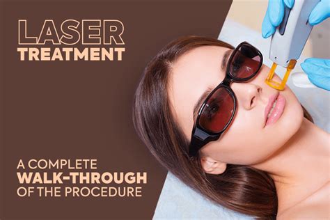 Laser Treatment Procedure, Limitation and Steps