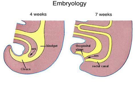 Genitourinary problems in patients with Anorectal Anomalies