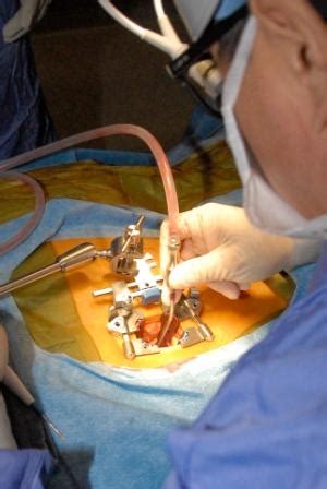 What is Minimally Invasive Spine Surgery? - ShimSpine