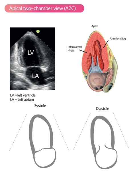 Standard Transthoracic Echocardiogram: Complete Imaging Protocol – ECG ...