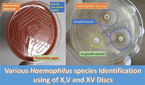 Various Haemophilus species Identification: Introduction and using of X,V