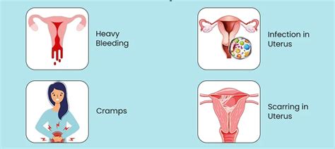 INCOMPLETE ABORTION - Nurses Revision