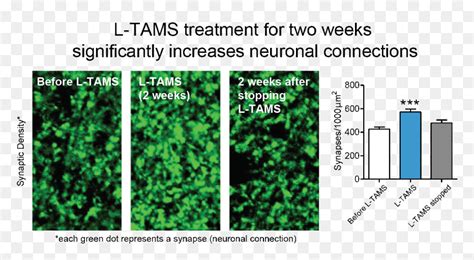 Synapses - Magnesium Threonate Brain, HD Png Download - vhv