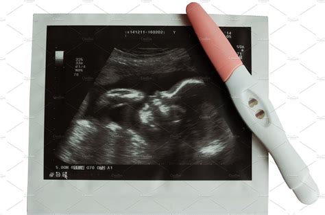 Ultrasound picture of baby with pregnancy test containing photo, ultrasound | Ultrasound ...