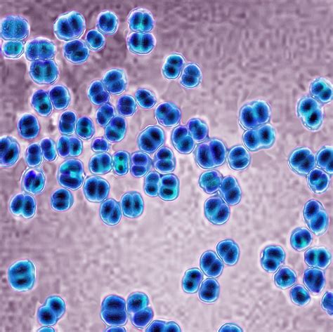 Neisseria Meningitidis Infection