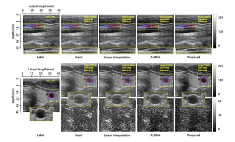 Deep learning for accelerated ultrasound imaging | KAIST MatriX