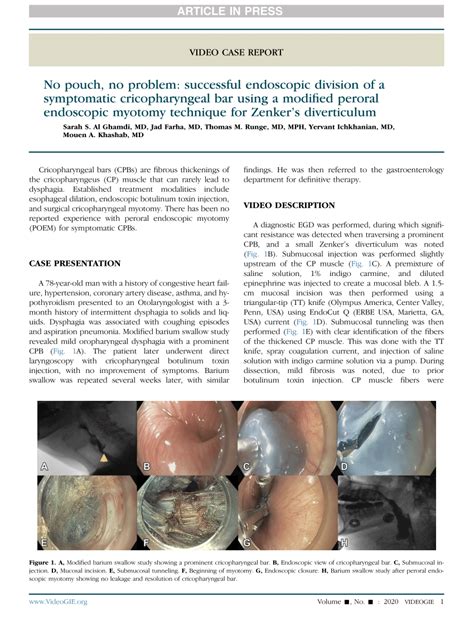 (PDF) No pouch, no problem: successful endoscopic division of a ...