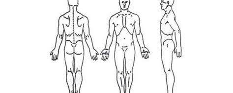 The pain drawing and Measurement of pain intensity - Orthopaedic ...