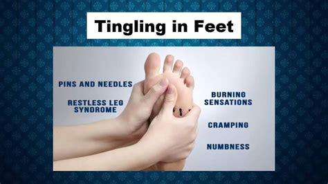 Tingling in Feet Symptoms and Signs - Tingling on Toes - Tingling of Legs and Feet - YouTube