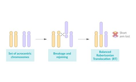 Translocation Down Syndrome Karyotype