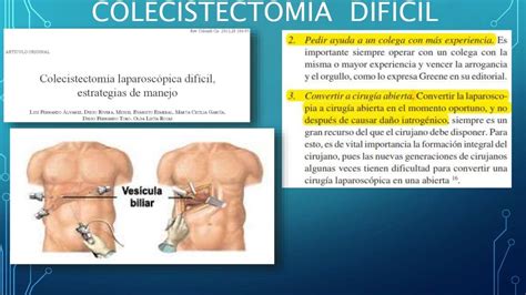 Colecistectomia Abierta y Laparoscopica