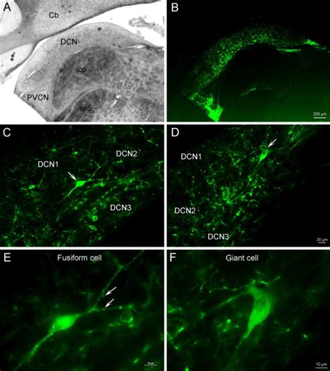 Channel rhodopsin (ChR2) can be produced in DCN neurons. Following a ...