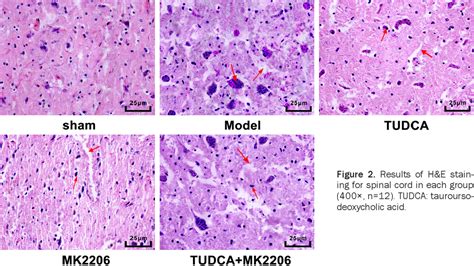 Figure 2 from Mechanism of tauroursodeoxycholic acid-mediated neuronal protection after acute ...