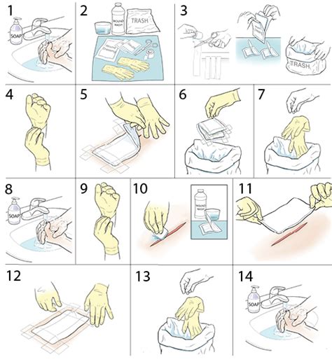 Step-by-Step: Changing a Wound Dressing | Saint Luke's Health System