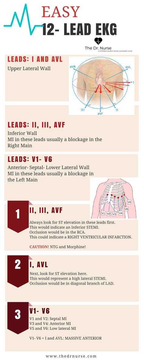 Use these THREE easy steps to learn 12-lead EKG interpretation. More like this at www.thedrnurse ...