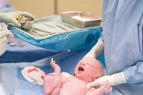 Photographer Shows 'C-Sections Are Beautiful' By Documenting Her Friend ...