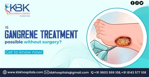 Is Gangrene treatment possible without surgery? Doctor for Foot Gangrene Hyderabad | by KBK ...