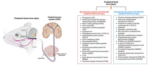 Facial Nerve Palsy Diagram