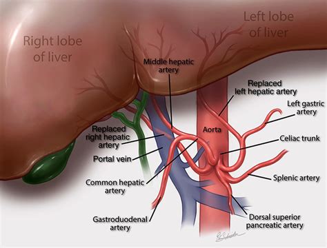 Common Hepatic Artery