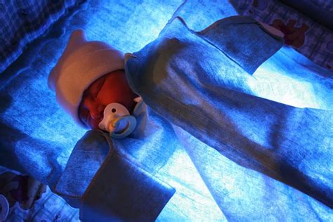 Bili Lights Phototherapy For Jaundice | Shelly Lighting