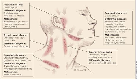 Where Do Cervical Lymph Nodes Drain - Best Drain Photos Primagem.Org