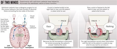 My Psychology Blog: Sperry and Gazzaniga: The Split Brain Study