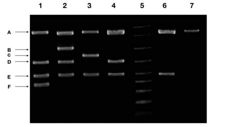 Part 2: Analysing and Interpreting (Agarose) Gel Electrophoresis Results