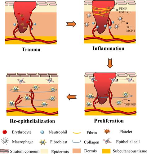 Phases Of Wound Healing Hemostasis Inflammatory Phase - vrogue.co