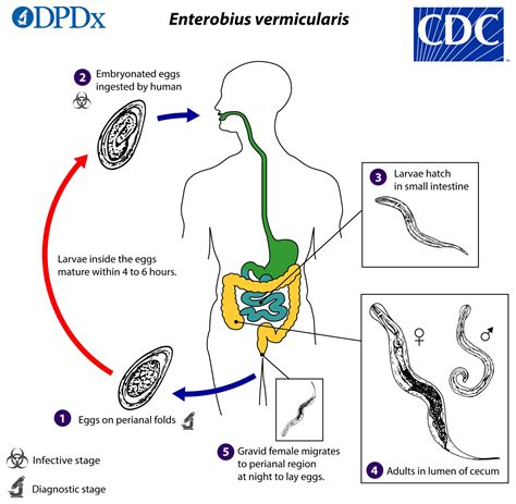 Aarsmaden (Enterobius vermicularis, oxyuris) (patientenfolder)