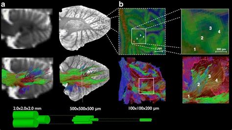 Tractography from macro- to microscale. a A conventional clinical DTI ...