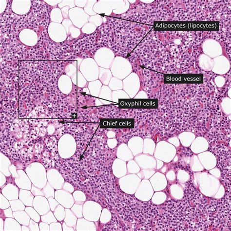 Dictionary - Normal: Parathyroid gland - The Human Protein Atlas | Histology slides, Human ...