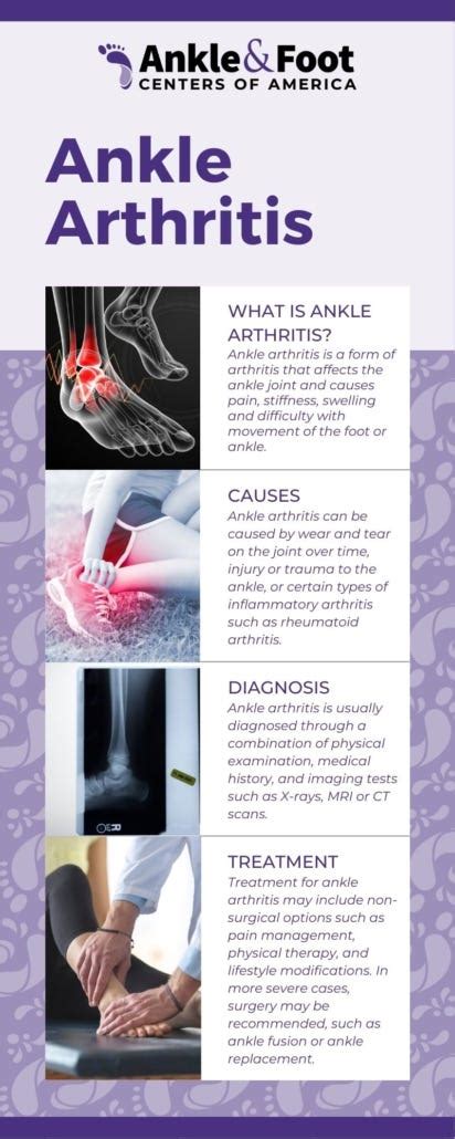 How to Prevent Ankle Arthritis? - Ankle & Foot Centers of America - Medium