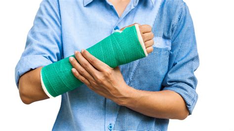 Difference between plaster, cast or plastic splints for broken bones