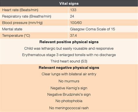 Ventricular Trigeminy